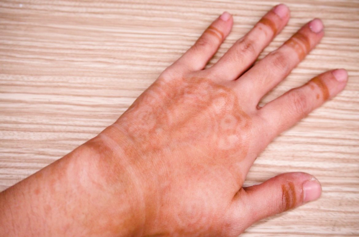 HACKS-SAY MEHNDI STAINS BYE